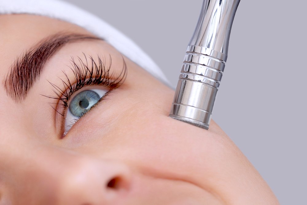 Microdermoabrasione Jet Peel