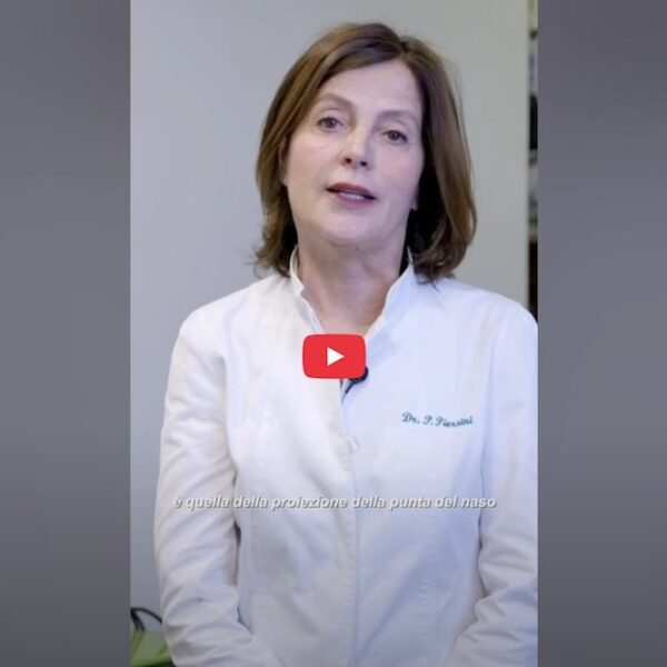 Sollevamento Punta del Naso con Filler Ialuronico