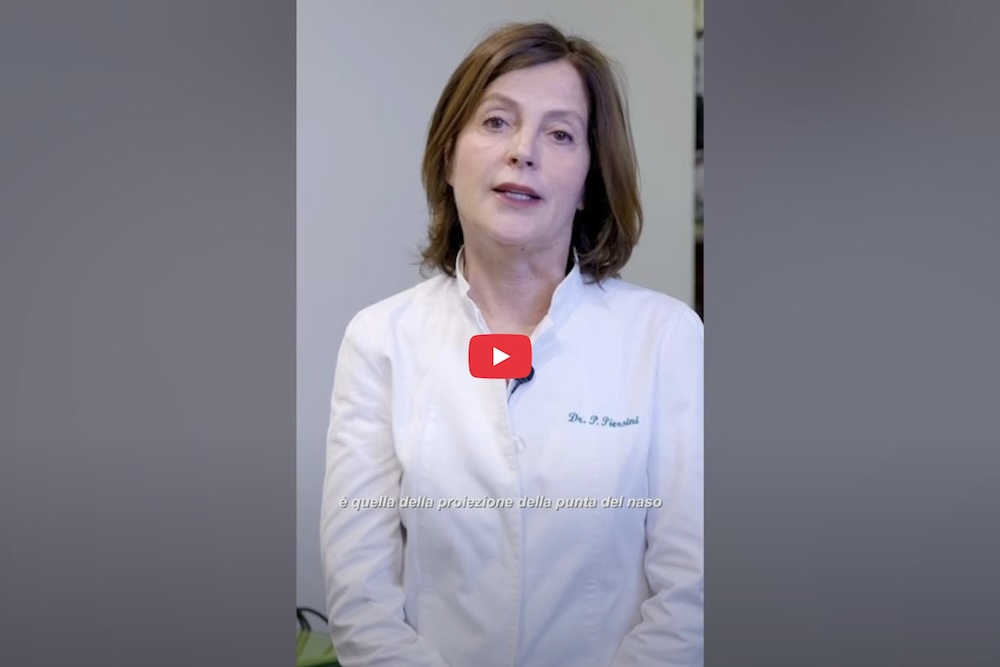 Sollevamento Punta del Naso con Filler Ialuronico