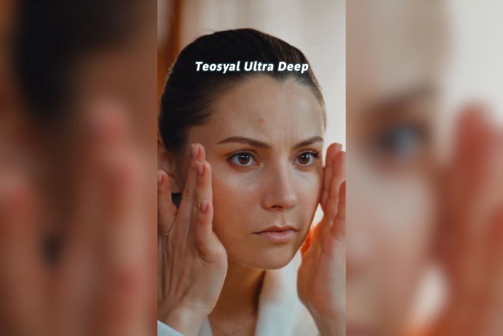 Effetto Lifting senza Chirurgia Ridefinire i Volumi con Teosyal Ultra Deep